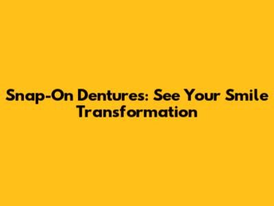 Snap-On Dentures: See Your Smile Transformation